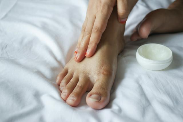 Close-up shot of a person applying antifungal cream on the foot