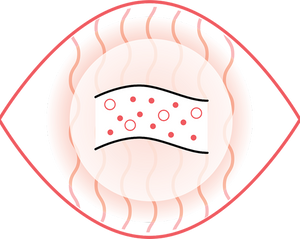 Improved Circulation: