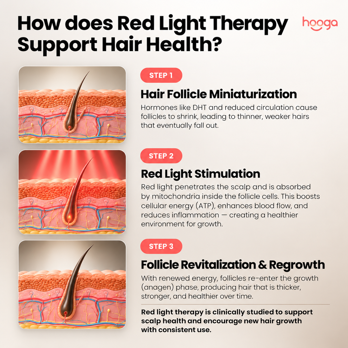Hooga infographic illustrating hair follicle miniaturization, red light stimulation, and follicle revitalization and regrowth.